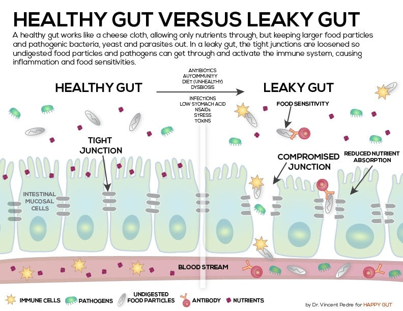 Leaky Gut, what is it?