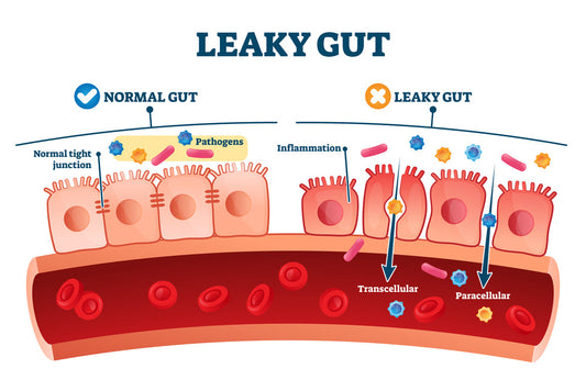 Leaky Gut, what is it?